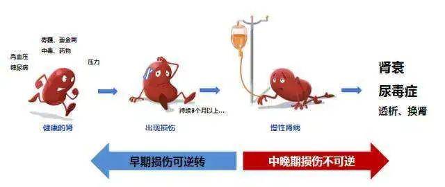 尿毒癥最新研究進展及突破與前景展望